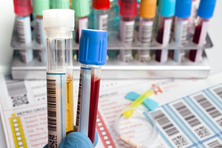 My Pet’s Blood Work What Does It Mean, and Why Is It Important? Twin